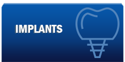 IMPLANTSBUTTON