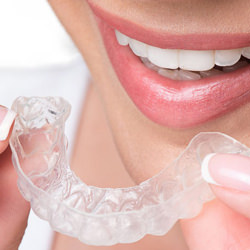 Invisalign